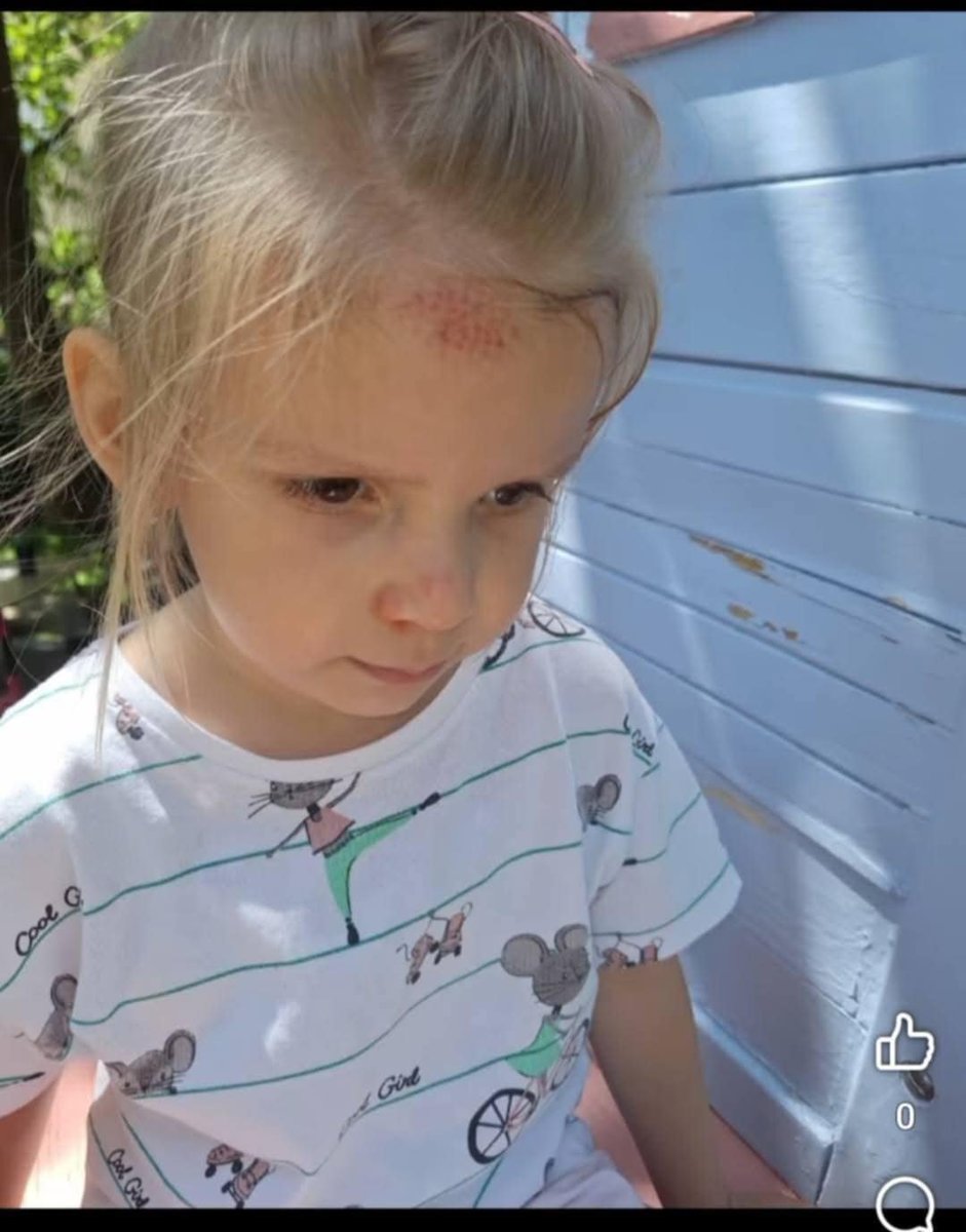AntonellaJ54036's tweet photo. Mama i tata vas mole da pomognete našoj Jani. ❤️
Jana ima 5 godina i retku genetsku bolest SCN8A. Svaki dan se borimo da joj pružimo terapije, preglede i šansu za napredak.
🙏 Pomozite nam da Jana nastavi svoju borbu. 📩 SMS 190 na 2407 🔗 https://t.co/7wbboDFItw
Svaka poruka i svaka donacija za Janu znači korak napred. ❤️