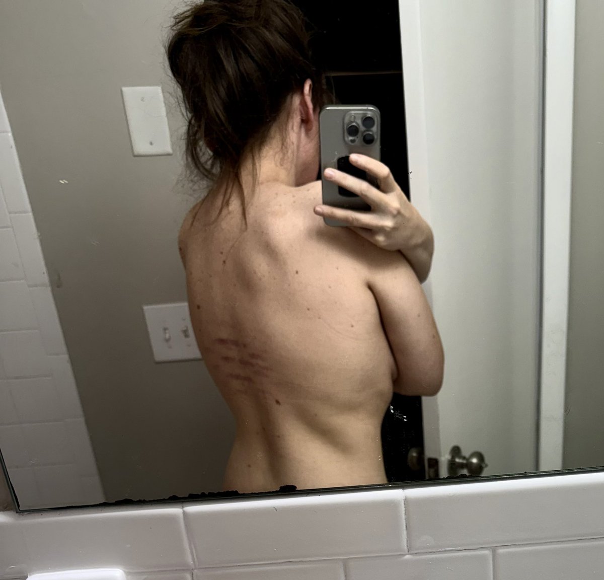 FollowsRabbit's tweet photo. No reason to worry about back pain when you have medical torture devices. https://t.co/rY5n1SEUrq