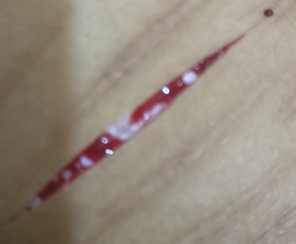 cerdaestupidaa's tweet photo. MI CAMARA ES UN ASCO

#FAKE #SFX #MAKEUP maquillaje realista super cute https://t.co/v6LEK53HbV