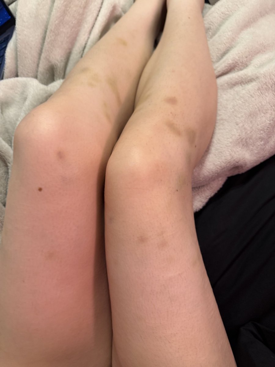 pure_hasumi's tweet photo. The reality of being “clean from sh” https://t.co/fcLkRNArdG