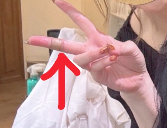 kurumingo7's tweet photo. @blueaoaimer アオちゃんへ

本日もまだ断髪痕がきえませんwww

皆様の悪運私が受けてたちましょう💪✨️ https://t.co/weUZdYnc5H