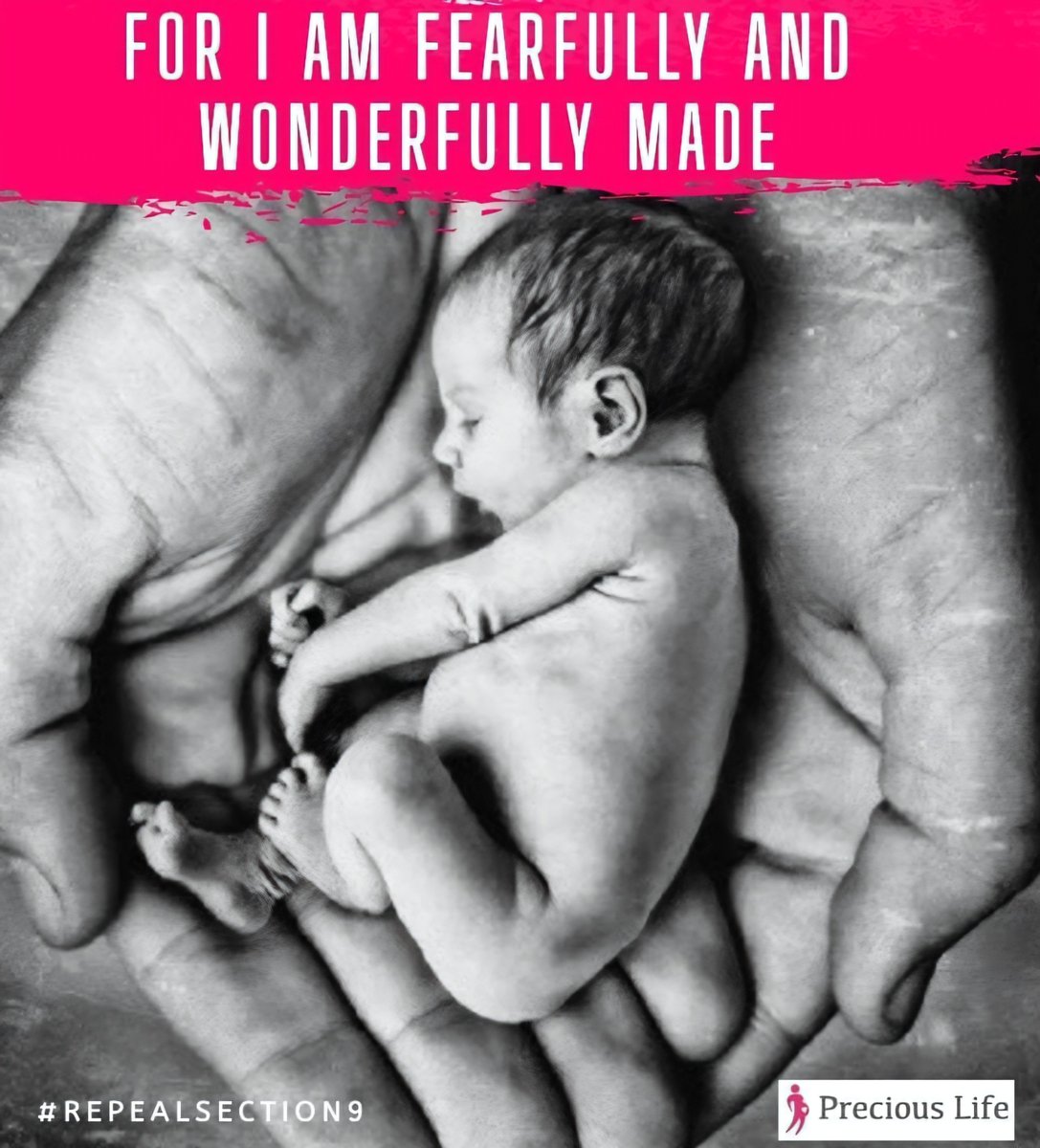 PreciousLifeCom's tweet photo. #SundaysForLife #PraytoEndAbortion https://t.co/8O2szzUr8K