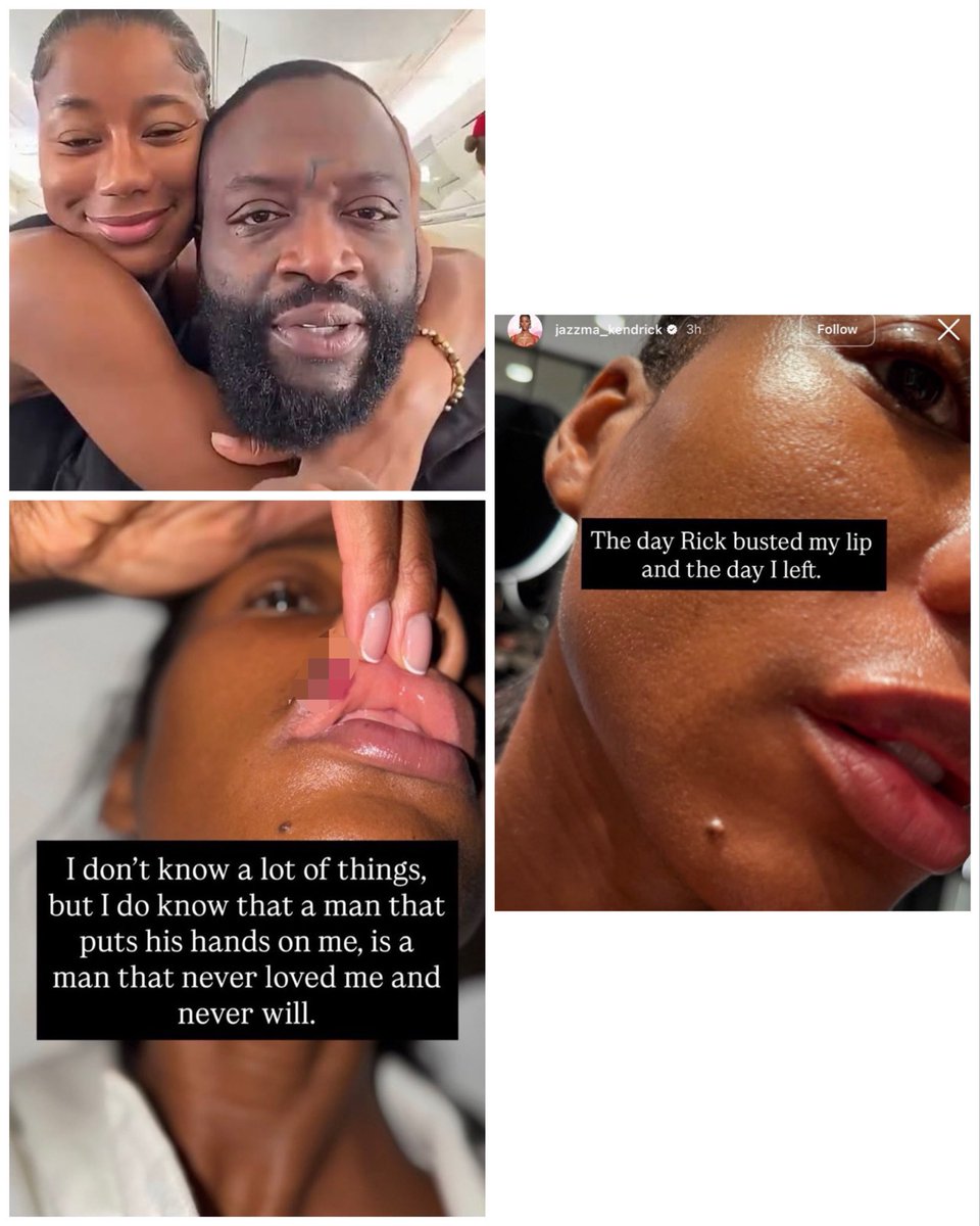 Naijablogger's tweet photo. Jazzma Kendrick Accuses Rick Ross of Domestic Violence, Claims He Treated Her as a “Punching Bag” and Busted Her Lip https://t.co/CgkbOHIJoK