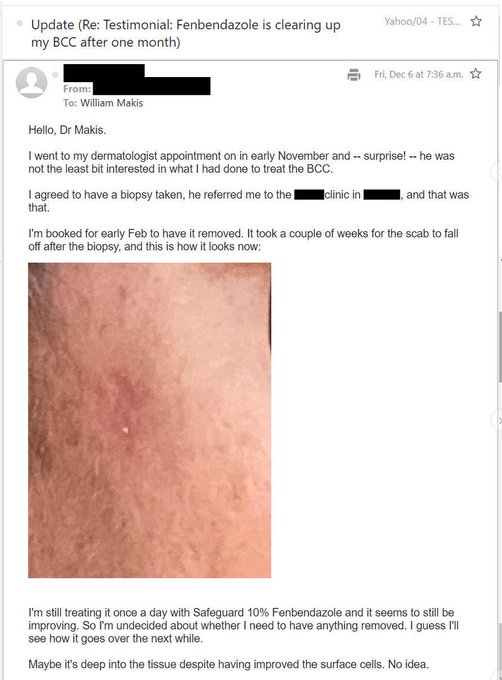 Dr_devd's tweet photo. 🧴 FENBENDAZOLE PASTE + BASAL CELL CARCINOMA: A PATIENT’S BEFORE-AND-AFTER STORY

A Canadian patient shared photographs documenting what he described as a biopsy-confirmed basal cell carcinoma on his right cheek. According to his account, the lesion had been present for months while he waited for dermatology care.

He says he began applying veterinary fenbendazole paste directly to the lesion. The photographs reportedly show changes over the following weeks, with the scab becoming smaller and the visible surface appearing substantially improved after roughly two months.

WHAT MAKES THIS CASE INTERESTING

• The patient reports a previous BCC diagnosis
• Fenbendazole paste was applied topically
• Visible changes were documented with photographs
• He still attended dermatology follow-up
• Removal of the lesion was reportedly still planned

The final point is particularly important. A skin lesion becoming smaller or disappearing visually does not confirm that basal cell carcinoma has been eliminated beneath the skin. Only appropriate medical assessment and, when indicated, pathology can establish whether malignant cells remain.

Fenbendazole has attracted attention in experimental cancer research, but veterinary fenbendazole paste is not an established treatment for basal cell carcinoma. This remains an individual testimonial rather than evidence that the treatment caused the reported improvement.

Cases like this can generate research hypotheses. Controlled studies are needed to determine whether there is a genuine therapeutic effect.

✨ Follow @Dr_devd  for more patient cases and emerging cancer research.

#Fenbendazole #BasalCellCarcinoma #SkinCancer #CancerResearch #DrugRepurposing #Dermatology #Oncology
