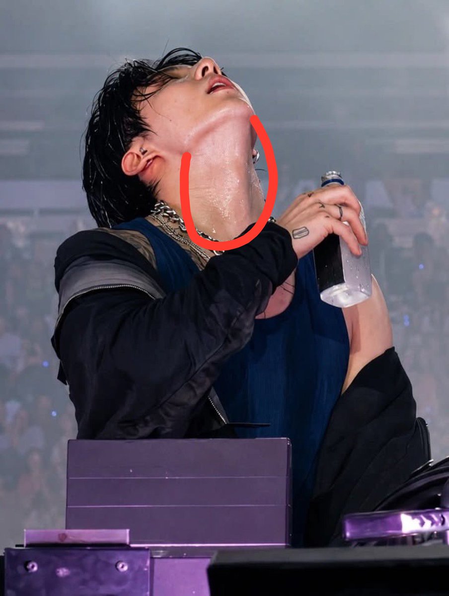 fck00z's tweet photo. @kwin025 It's normal bitch not like plastic queen jaw😭 https://t.co/XyMENLC3Uk