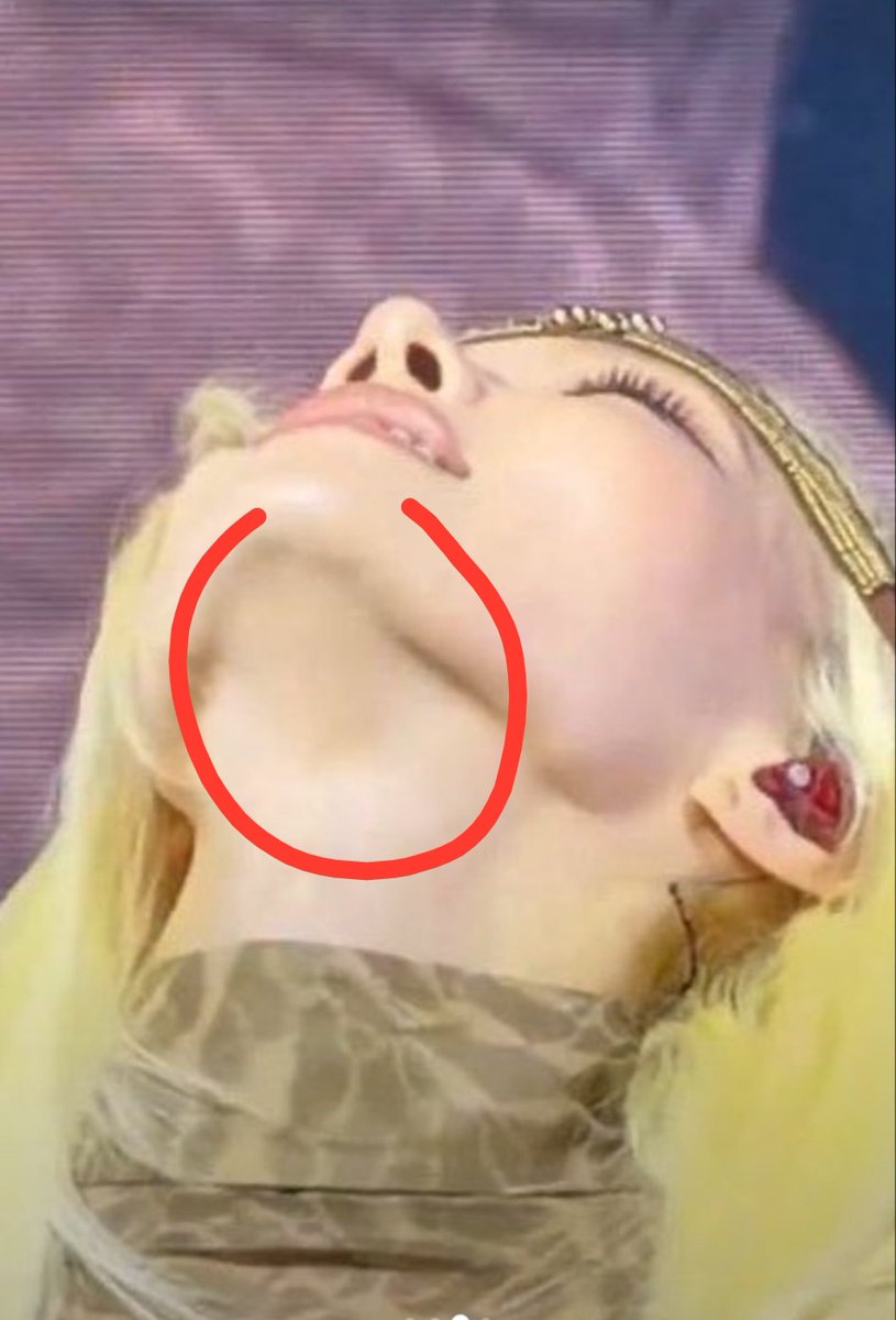 fck00z's tweet photo. @kwin025 It's normal bitch not like plastic queen jaw😭 https://t.co/XyMENLC3Uk