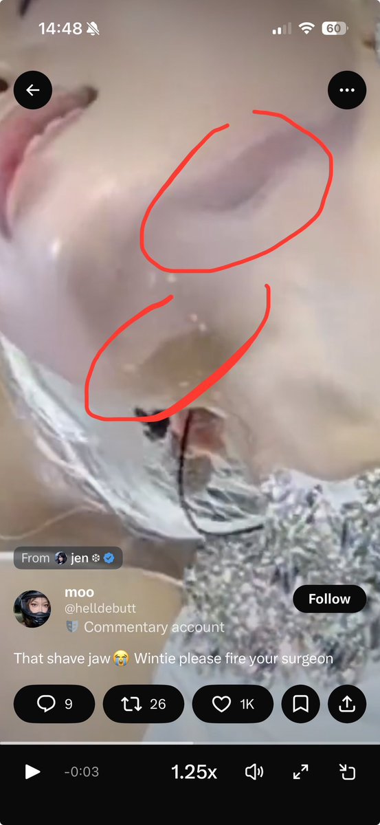 fck00z's tweet photo. @kwin025 It's normal bitch not like plastic queen jaw😭 https://t.co/XyMENLC3Uk