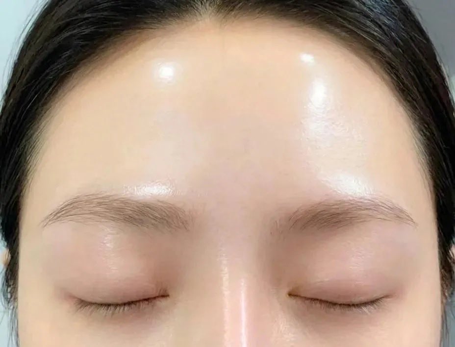 lynn47328587332's tweet photo. 皮膚科の先生にすすめられて使い始めたら横転。1か月後には「肌きれいになった？」って聞かれるようになった。
これはもっと早く知りたかったやつ🥹￼ https://t.co/w9UmwMkY3K