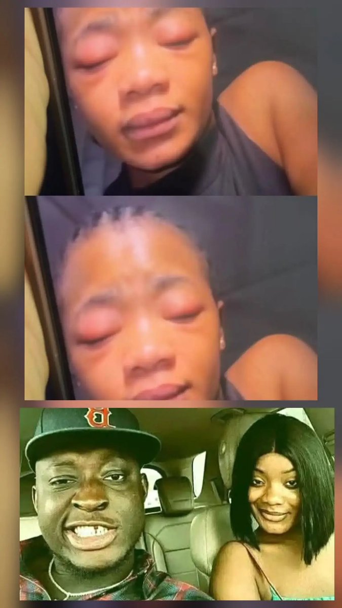 Zevrix00's tweet photo. the Nigerian authorities should investigate the matter properly and urgently. The woman’s safety must come first, and anyone found responsible should face the law. No one should be above the law when it comes to domestic violence.
@PoliceNG https://t.co/qmxrwxS2v0