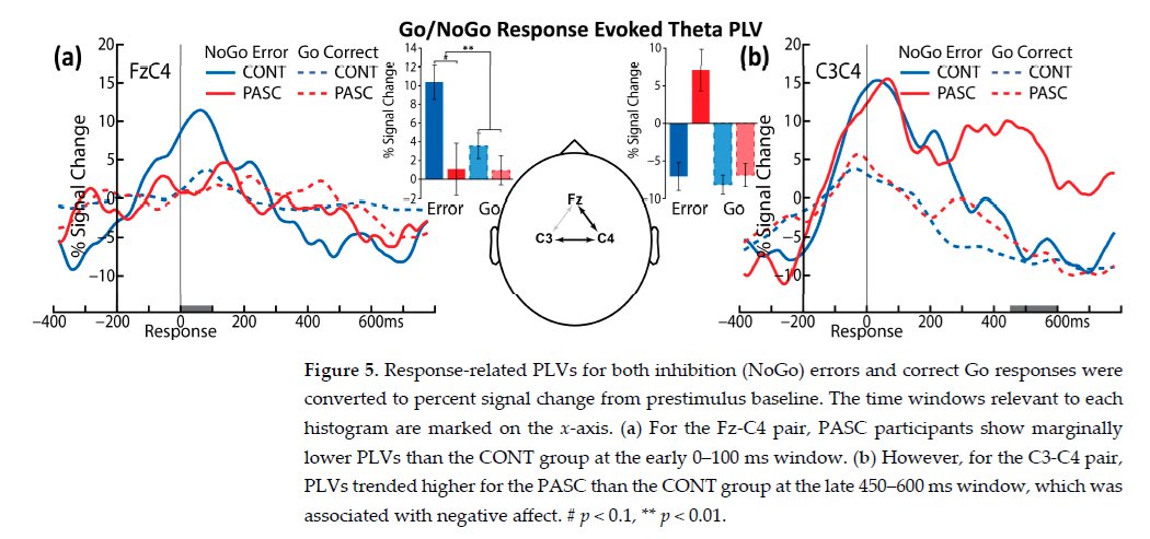 HarrySpoelstra's tweet photo. Neurocognitive Indices of Long COVID: Dysregulated Engagement of Inhibitory Control and Oscillatory Slowing

🚨Even after mild COVID, LongC0VID can leave a measurable brain signature.

Interesting small USA study that needs your attention:

➡️~6 months later, young, otherwise healthy adults with PASC reported more brain fog, anxiety, depression and sleep problems,

➡️On an inhibitory Go/NoGo task their performance looked intact, but EEG did not,

➡️Neural indices showed altered cognitive-control engagement on both correct and error trials, less efficient responding, and a trend toward dysregulated co-oscillatory synchrony during errors,

➡️Altered neural indices of inhibitory control marginally correlated with spontaneous oscillatory slowing, potentially suggesting shared basic mechanisms,

➡️“The overall pattern of PASC symptoms, altered neural activity during inhibitory control, and oscillatory slowing, is indicative of the core neural dysfunction characterizing PASC”.

‼️So, LongC0VID here is not symptoms without a signal. It is a core neural dysfunction that behavioral tests miss and EEG detects.

‼️In layman terms: After even a mild COVID infection, some people keep the fog, the bad sleep, and the low mood. Everyday tests may say nothing is wrong. The brain however can be working less efficiently, especially when it has to stop itself, stay on task, or recover from a mistake, and to be honest, I'm seeing a lot of this around me!
#AvoidSars2 #AvoidReinfections
https://t.co/VGKcyiHgnm
https://t.co/oTZ5wPdy6g