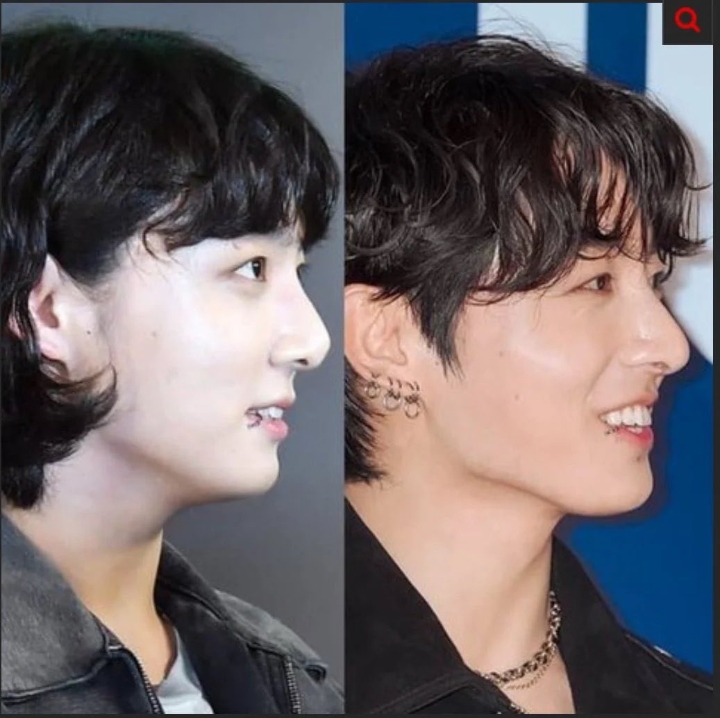 TheHateBase's tweet photo. Jungkook gets jaw and nose surgery every month, and his fans are obsessed with everyone 😭 https://t.co/WATRA8B5eY
