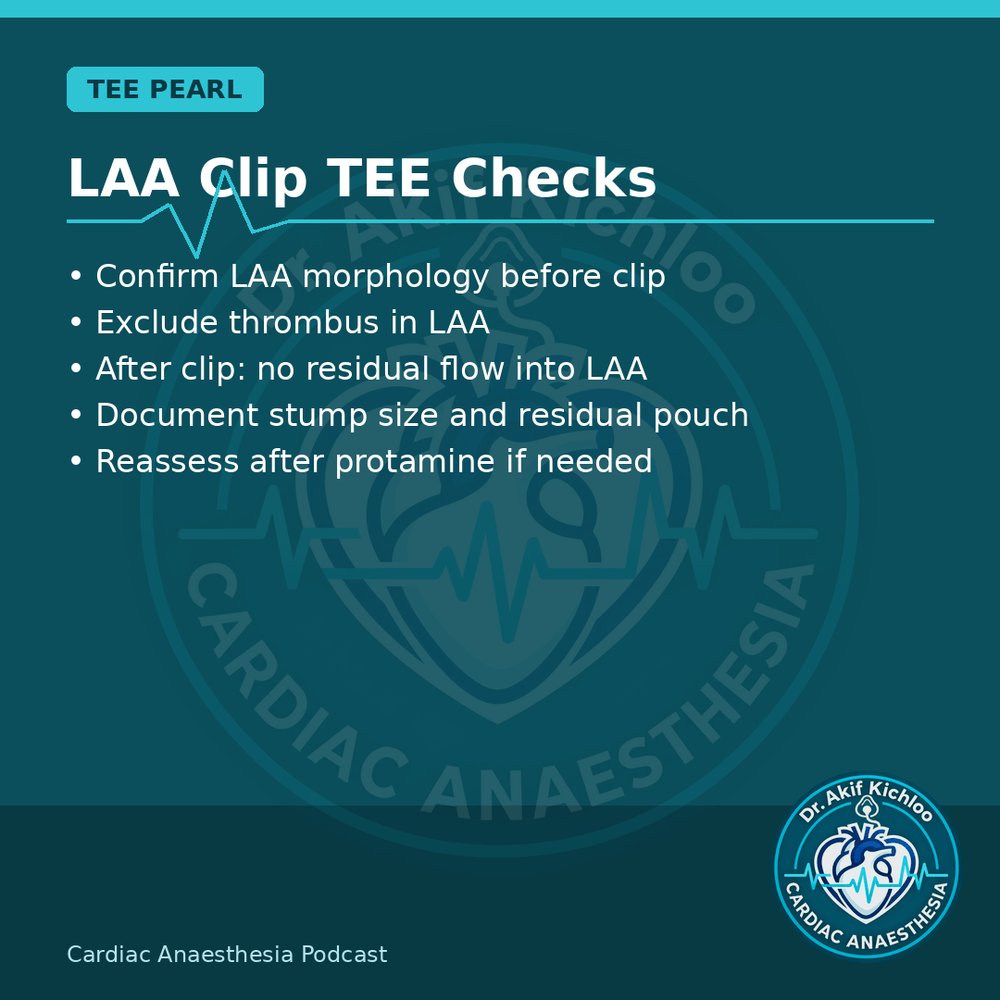 akifkichloo's tweet photo. MUF, LAA, ECMO &amp; AS
MUF vs CUF, LAA clip TEE, ECMO cannulation, low-flow low-gradient AS.
Cardiac Anaesthesia Podcast
#CardiacAnaesthesia #CardiacAnaesthesiaPodcast #MedEd #CardiacOR https://t.co/HpmhnXc1Sh