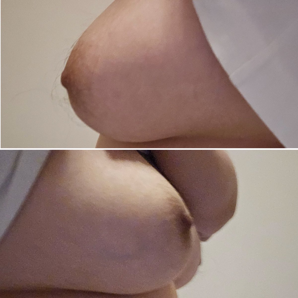 YuqiOops's tweet photo. 乳晕有毛毛好羞耻
说好像多囊和雄激素过高
会导致多毛
我这是木瓜胸还是水滴？
总之不是下垂就行
下垂好像是乳头低于下胸围分界线
依旧发完半夜删（过于羞耻）
忽略刚吃完一顿大餐的肚肚
原图无修
#wlw #le #拉拉  #女同 https://t.co/Wlr78bOe0r