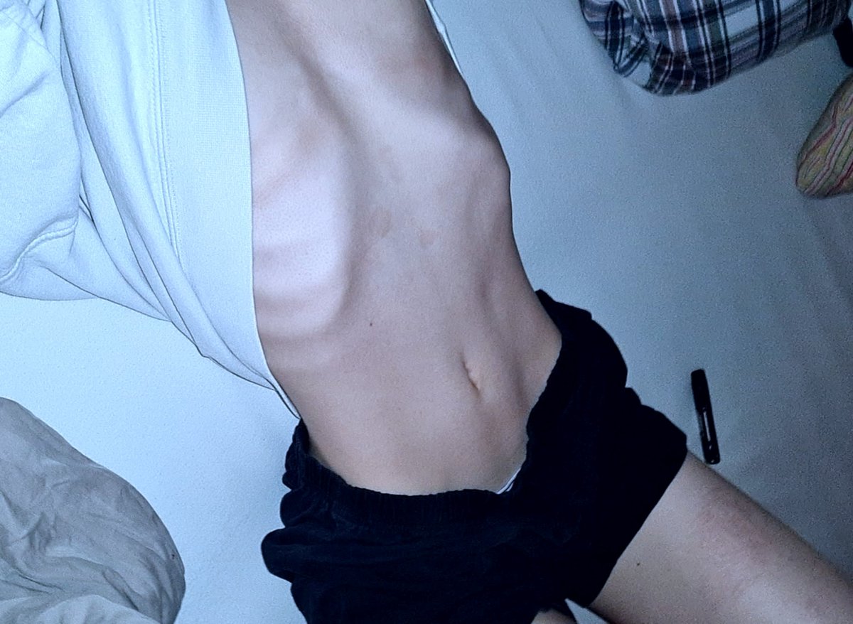 ezraxhell's tweet photo. I'm back on #edtwt #edtw

I did recover(from a weird mix of bulimia, ana and alcoholism) to safe my life. 

back at it tho. let's see how far we can take it this time. 
#bodycheck https://t.co/U7G86WRcun