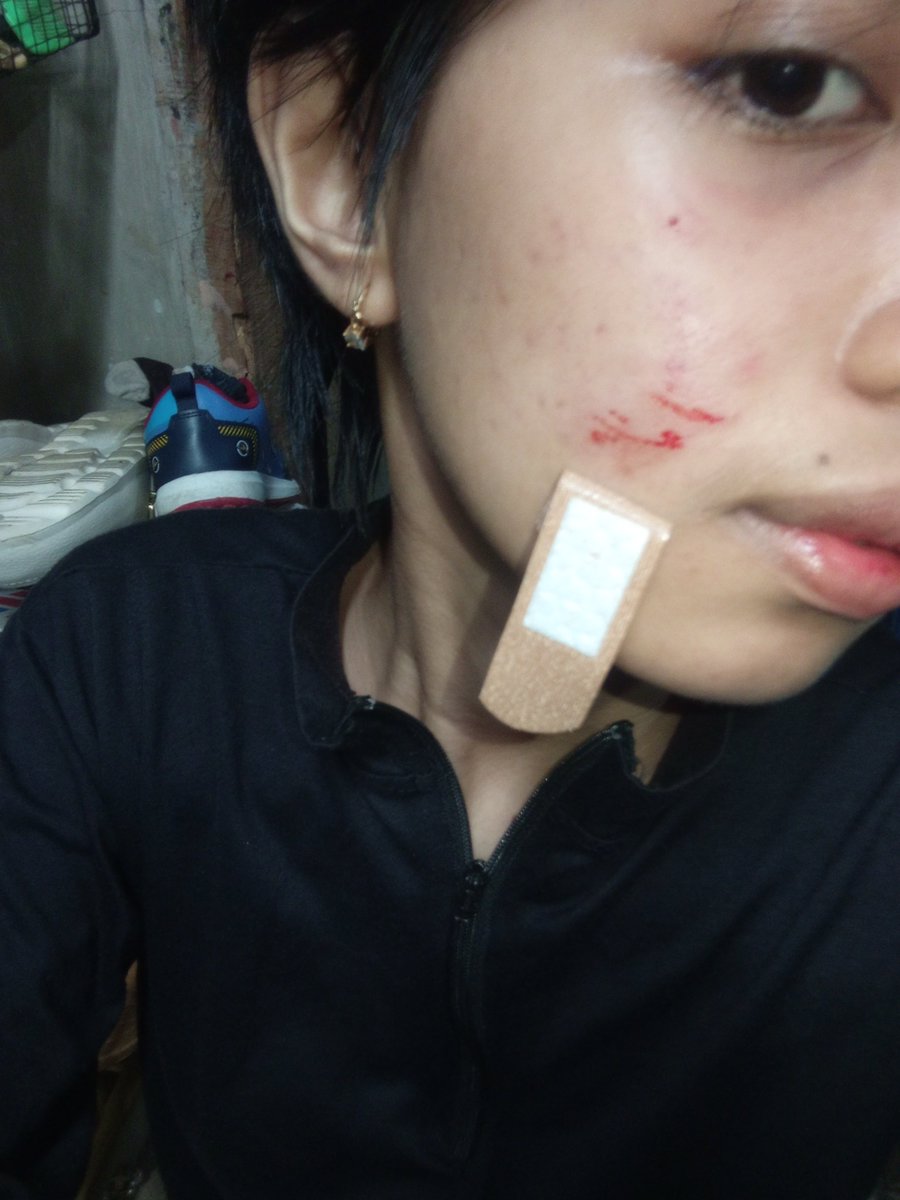 puttpnyjn's tweet photo. Di cakar adek anj https://t.co/W3traqJ5B5