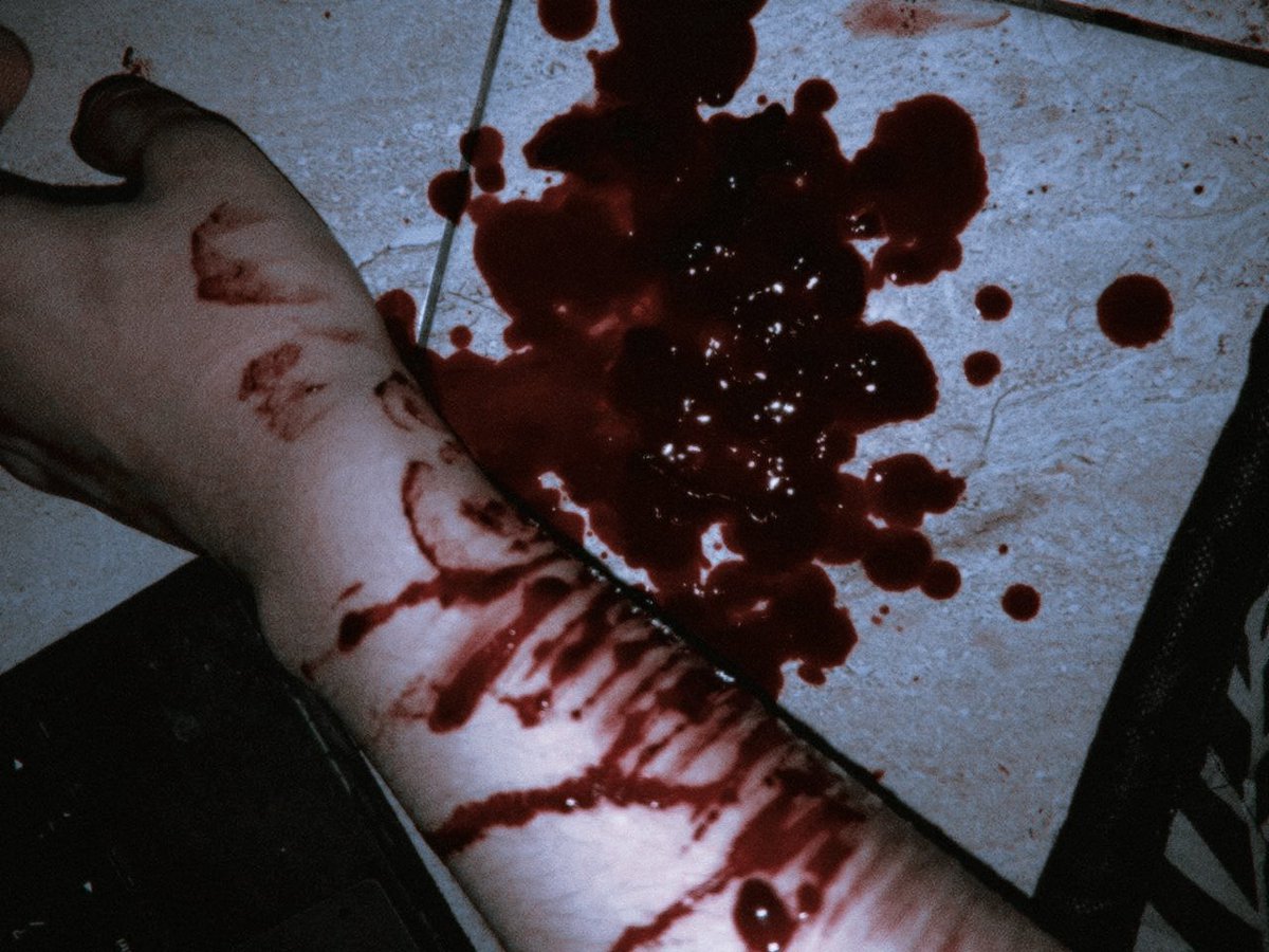 sherylsarchieve's tweet photo. Blurry, hazy.
#slittwt 
.
Not real. Realistic sfx makeup for theatrical performance purposes. https://t.co/OJwVzqH6e6
