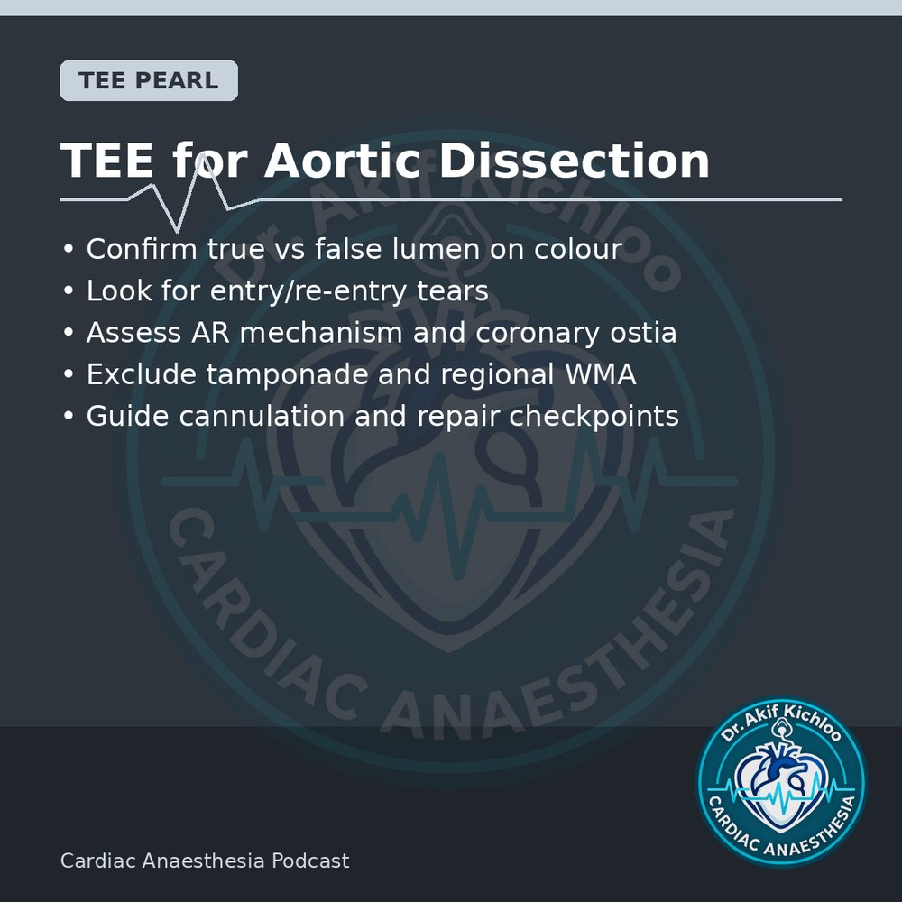 akifkichloo's tweet photo. TEE, Mini-Mitral &amp; VIS
TEE for dissection, mini-mitral points, VIS, lactate on CPB.
Cardiac Anaesthesia Podcast
#CardiacAnaesthesia #CardiacAnaesthesiaPodcast #MedEd #CardiacOR https://t.co/uABX9mL34R