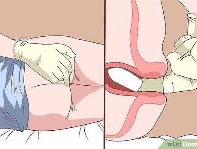 Hope_Pride6's tweet photo. Anal stretching to a significant size should never be approached randomly or rushed. The body needs time, gradual progression, and care. Forcing it or ignoring pain can lead to tears, bleeding, and other injuries.

Education, patience, appropriate lubrication, and stopping when something hurts are essential for safety. Never let pressure from others make you risk your health.

#LGBTQ #GayHealth #SexualHealth #AnalHealth #LGBTQHealth #SafeSex