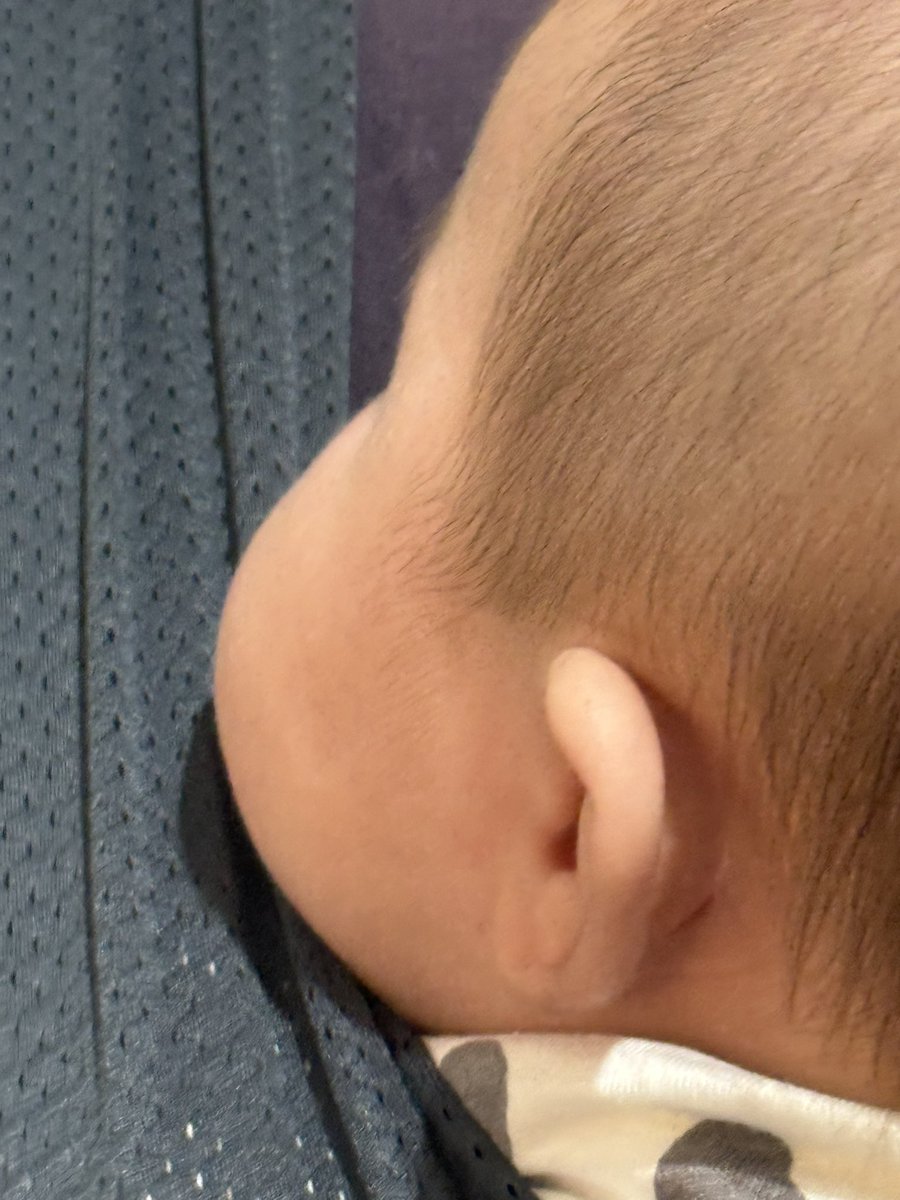koyama666's tweet photo. 抱っこ紐から
はみ出る魅力のほっぺた👶

#ボイル日記 https://t.co/YywGRV0Gq8