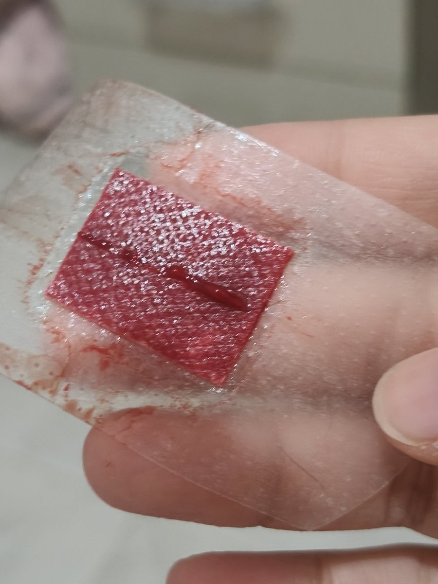rllapsev's tweet photo. i think i put too much fake blood on my SFX FAKE make up,, its all fake!! sfx make up for halloween incoming🎃🎃🎃!! NO SELF-HARM INVOLVED!! i believe self-harm is wrong and unhealthy!!! https://t.co/PFgjWGeQgl