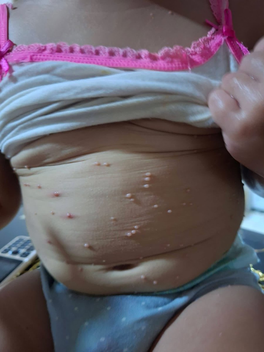 rola_almoghrabi's tweet photo. MY CHILD IS DYING😭

︎
︎

︎

︎

︎

︎
︎

︎

︎

︎

we’ll remind you
︎

︎

︎

︎

︎
︎

︎

︎

︎

︎
︎

︎
︎

︎
︎

︎

︎

︎

︎
︎

︎

︎

︎
that
︎

︎

︎

︎

︎

︎
︎

︎

︎

I desperately need TREATMENT for my baby🍼
https://t.co/FLk3iM7URh https://t.co/XQuDUnUZuJ
