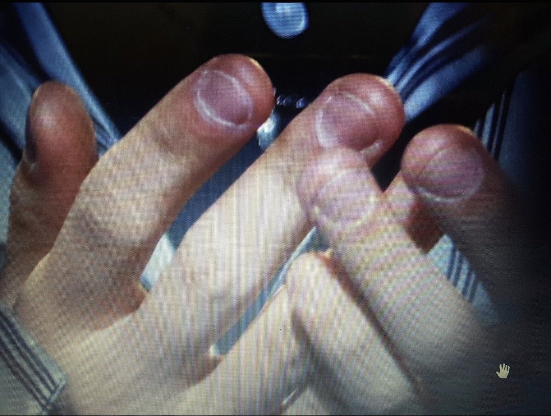 _ChanaDO's tweet photo. น้องคยองซูเก่งที่สุดที่เลิกกัดเล็บได้ ตอนนี้เล็บสวยสุขภาพดีมากๆ 🫳🏻 https://t.co/i8lSsIWgxu