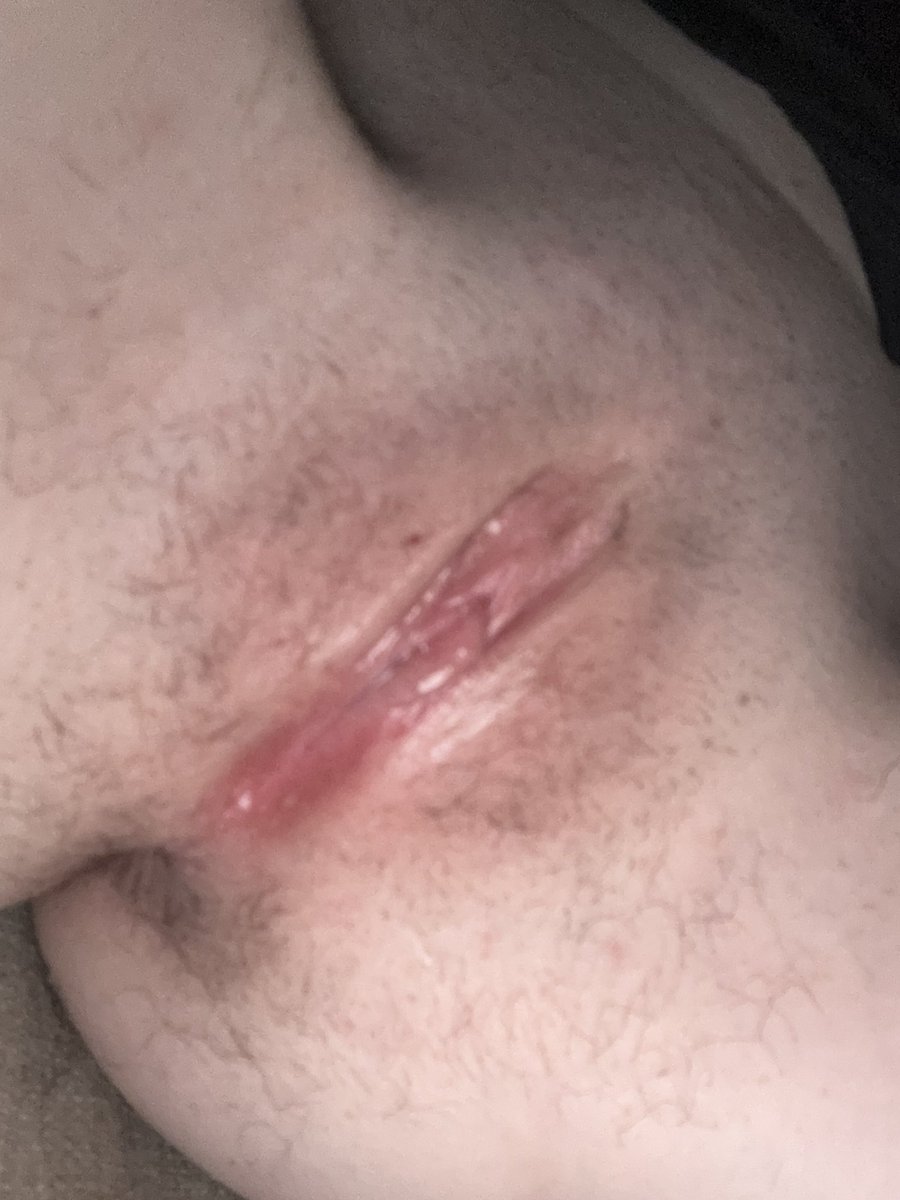 maddmoongirl's tweet photo. My 🐱 is so swollen after I finish #nude #pussy https://t.co/BCRgpJtiZ6