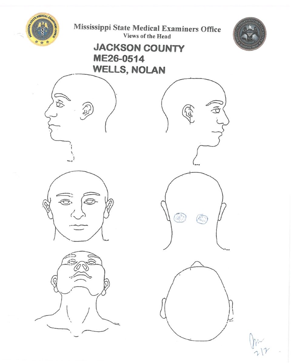 AttorneyBCrump's tweet photo. The Mississippi State Medical Examiner's autopsy report found no water in his lungs or airways, despite the grand jury report suggesting Nolan Wells' death was an accidental drowning. The cause and manner of death remain undetermined, with documented evidence of head injuries https://t.co/YJSb8zdOyu