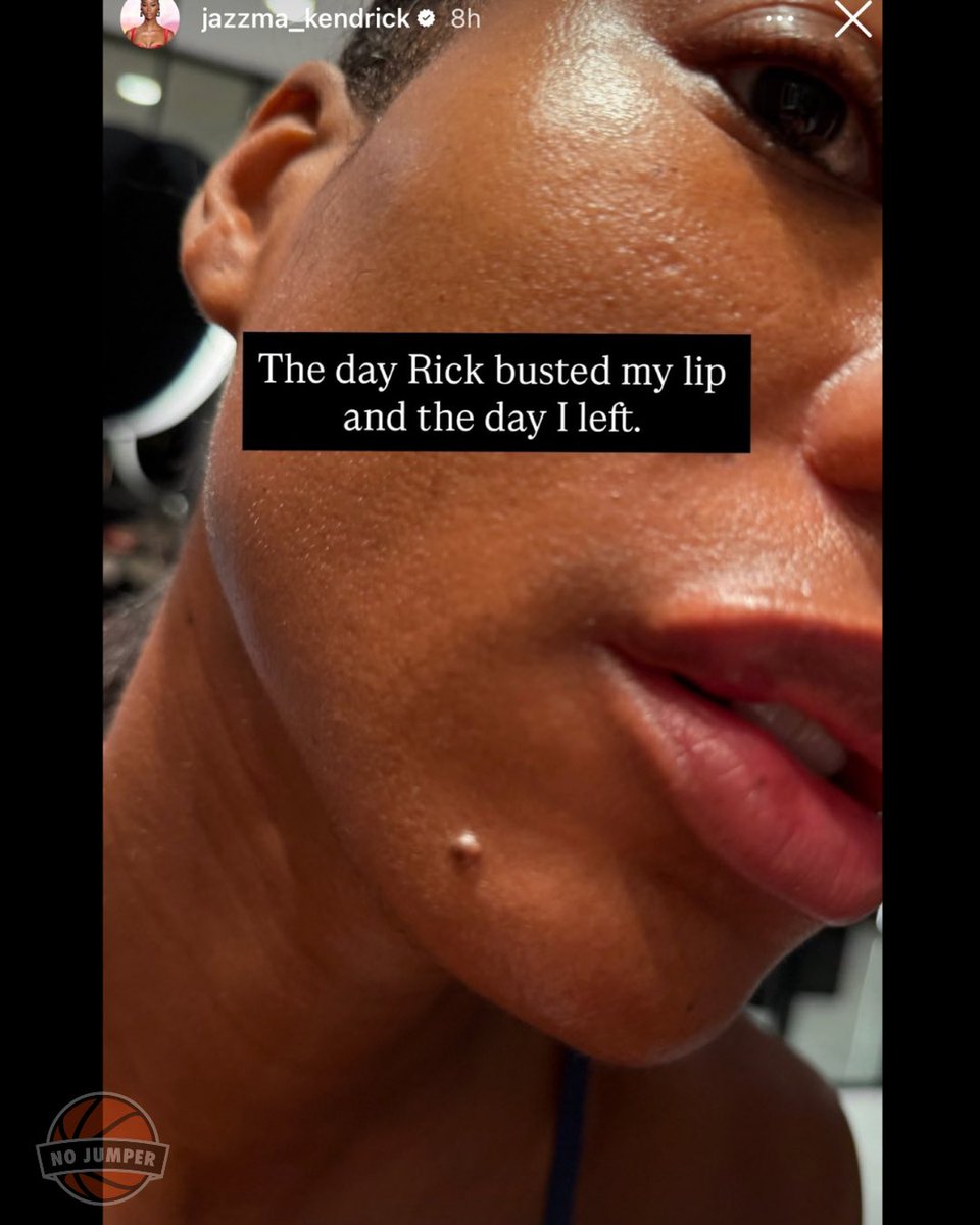 nojumper's tweet photo. 50 Cent speaks on the Rick Ross situation after Jazzma Kendrick accused Ross of physically assaulting her and shared photos of her injured lip. 

“This punk put his hands on baby girl, he stressed that album didn’t sell.” https://t.co/KJYN13cYCh