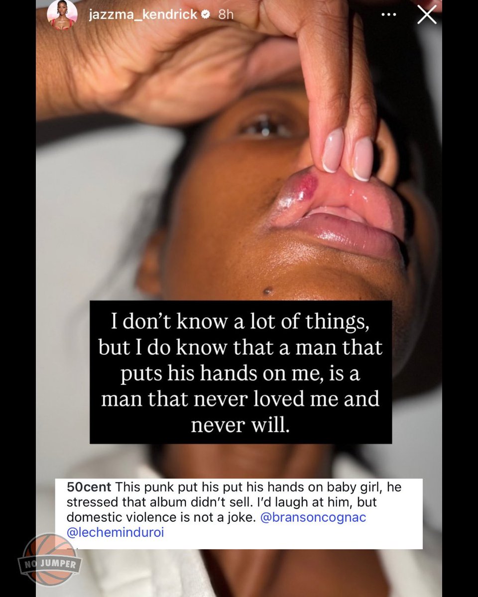 nojumper's tweet photo. 50 Cent speaks on the Rick Ross situation after Jazzma Kendrick accused Ross of physically assaulting her and shared photos of her injured lip. 

“This punk put his hands on baby girl, he stressed that album didn’t sell.” https://t.co/KJYN13cYCh