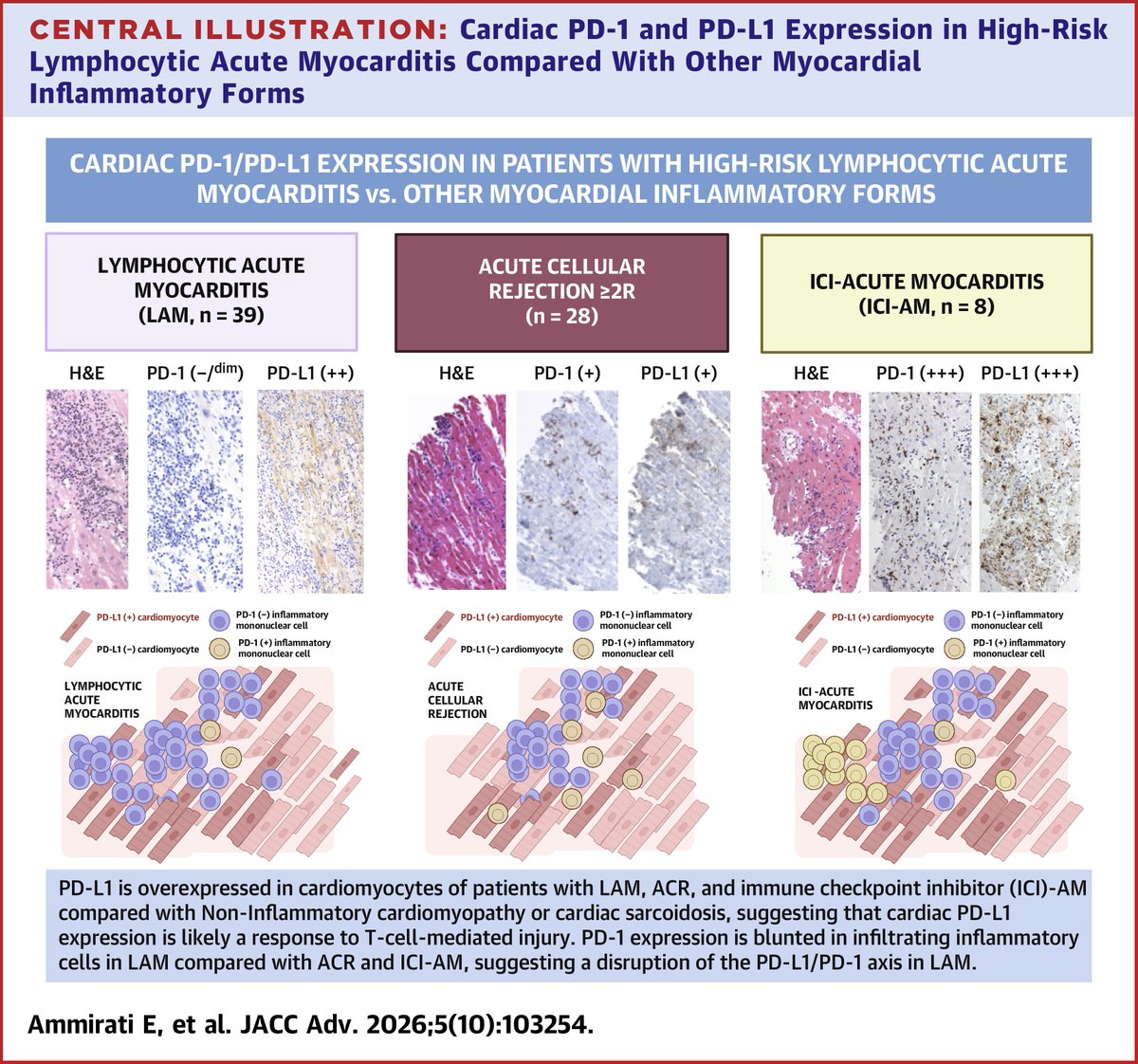 AmmiratiEnrico's tweet photo. Our findings suggest a disruption of the PD-L1/PD-1 axis in lymphocytic acute myocarditis,
representing a potential target for future therapies.
@CardioOncology
@EricAdler17 

https://t.co/aTMIyh9US6 https://t.co/0fwCJJGPSv