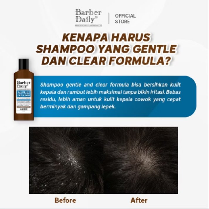 budi53t14w4n's tweet photo. Shampoo gentle and clear formula bisa bersihkan kulit kepala dan rambut lebih maksimal tanpa bikin iritasi. Bebas residu, lebih aman untuk kulit kepala cowok yang cepat berminyak dan gampang lepek
#rekomendasi #rekomendasi perawatan rambut #saran #spil
https://t.co/HUTru9zV26 https://t.co/wN7uoL0RwK