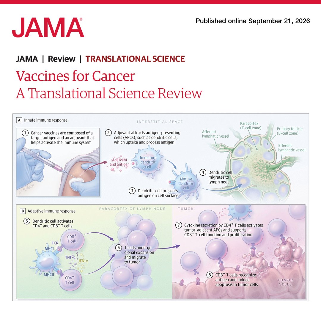JAMA_current's tweet photo. 📝 #JAMAReview: #Cancer vaccines are being evaluated for treatment and prevention across multiple malignant neoplasms as advances in tumor immunology, antigen discovery, and vaccine delivery reshape the field. 

This Review discusses how vaccines can stimulate adaptive immunity against neoantigens, nonmutated tumor proteins, or tumor-derived antigens, with current approved uses in melanoma, prostate cancer, and bladder cancer.

🔗 https://t.co/f4OJ6Qsyxx