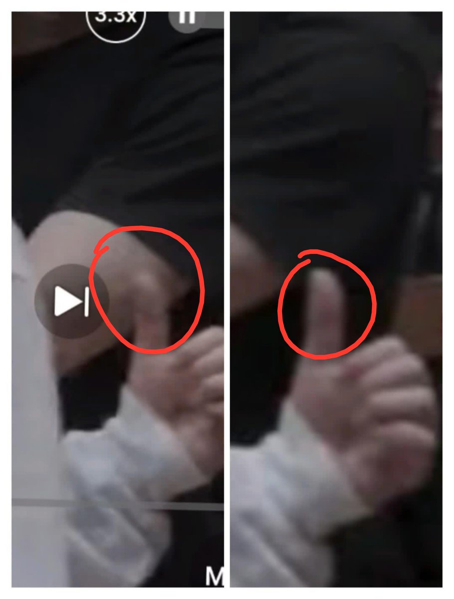 urkikibae's tweet photo. Yeahh they couldn't edit it properly cause why does that Shadow also appears on jimin thumb lol did bighit editor forget to edit the Shadow on his arm properly thats why that Shadow is half on JK arm half of jm thumb Its always bighit editing shadows and marks on his arm always💀 https://t.co/nxyr5Dnery