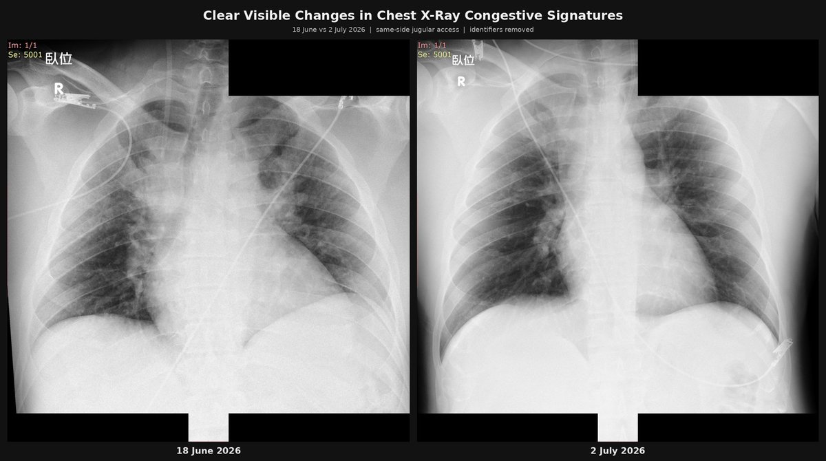 burzart1's tweet photo. @IntegralAnswers @ktho641521 @lcbarbarian At best he reverses a terminal condition caused by Pfizer and saves someones life. 
Why is it again that only Edogawa can treat people dying due to the covid vaccine?
Why are doctors around the world are completely clueless about what they forcibly injected people with? https://t.co/nKjipv6pru