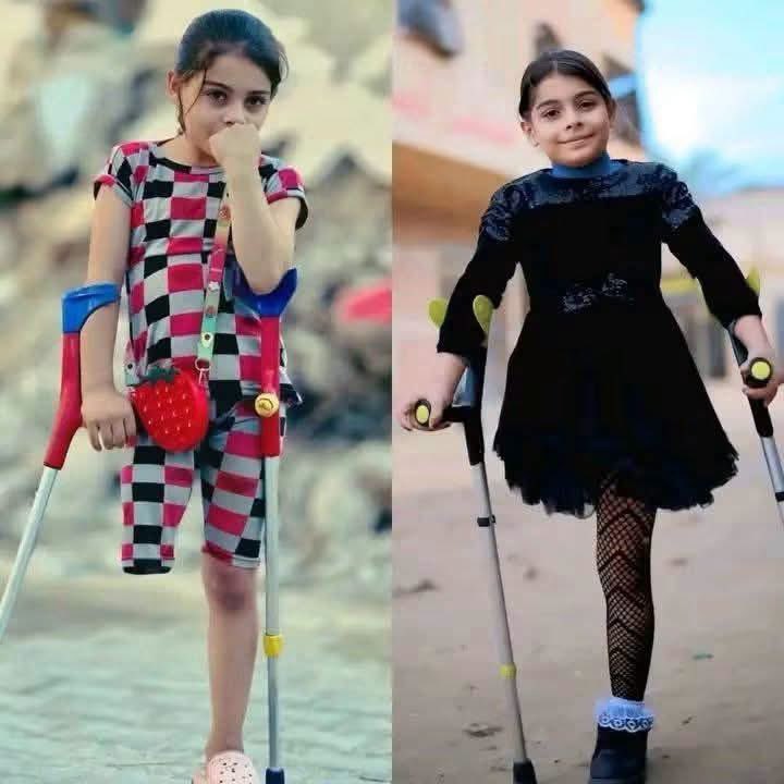RomaissaTahar's tweet photo. She is only 8 years old... 🥺💔 While other children are dreaming of toys and school, she is fighting a battle no child should ever face. She lost her leg, but the pain didn't stop there. Her bones are growing abnormally, causing her severe agony every single day.1/2 https://t.co/tkDa1WGmFj