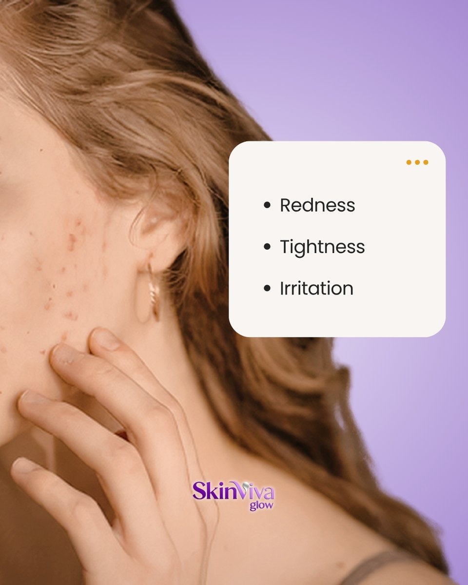 GordonRudisill's tweet photo. If your skin suddenly feels extra sensitive, dry and tight, red or irritated, or stings after skincare, your skin barrier may be struggling. The solution may not be more products, but fewer. Over-exfoliating, using too many actives, or constantly https://t.co/zKoEqF2Sla