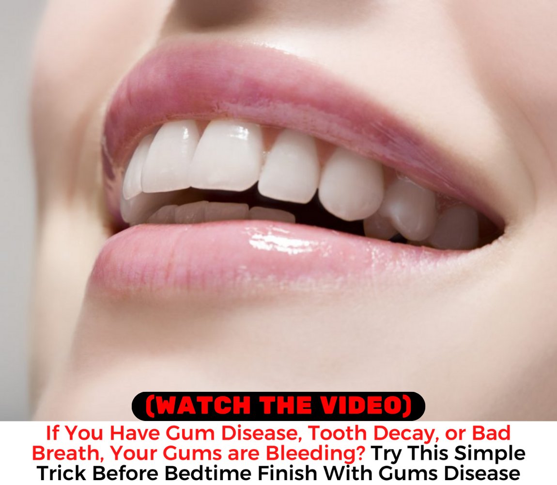 WinJose8's tweet photo. #dental #dentalcare #teethgoals #prodentimprobiotic
#teeth #smiles #prodentim #whiteteeth #healthcare
#OralCare #tooth #decay #viral #DentalHealth
Invest in your smile with our
trusted dental care product.
👉 https://t.co/DIq2xACU4x 👈 https://t.co/iHG6W2JNhw