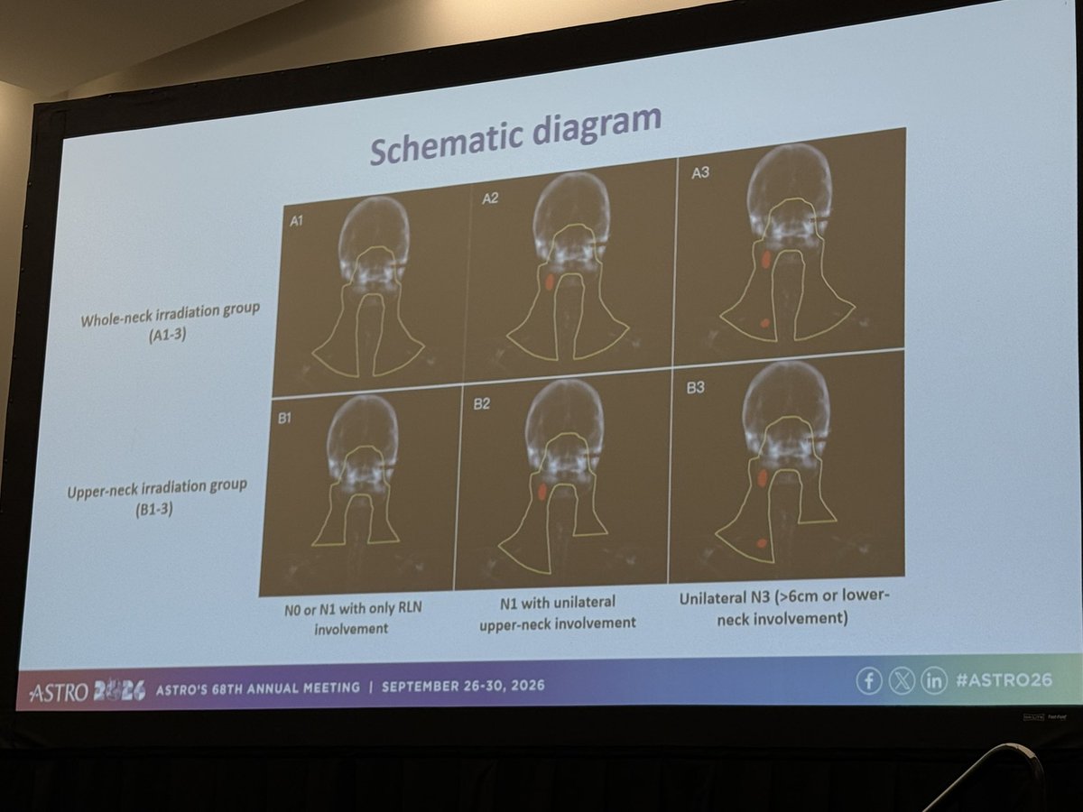 CJTsaiMDPhD's tweet photo. 👏⚡️Dr. Huang from Sun Yat-Sen presented stellar 10yr Outcomes of Elective Upper vs. Whole-Neck RT for the Uninvolved Neck in NPC with preRT high EBV viral load!

#ASTRO26 
@ASTRO_org @DavidSherMD @KaramLab @ScottBratman https://t.co/zK0ka185fA