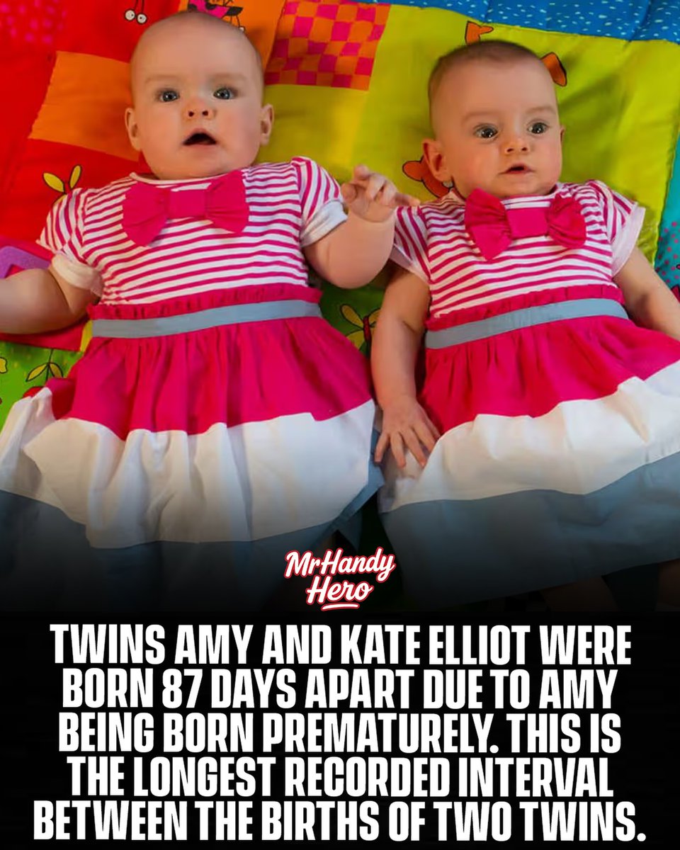 benjaminleeu6qq's tweet photo. These twins were born 87 days apart. Amy arrived prematurely at 24 weeks, weighing just 1 lb 3 oz. Her mother’s contractions then stopped, allowing Kate to remain in the womb for another 87 days before being born at 36 weeks. Their 87-day, 1-hour, https://t.co/6WUISfq4Iw