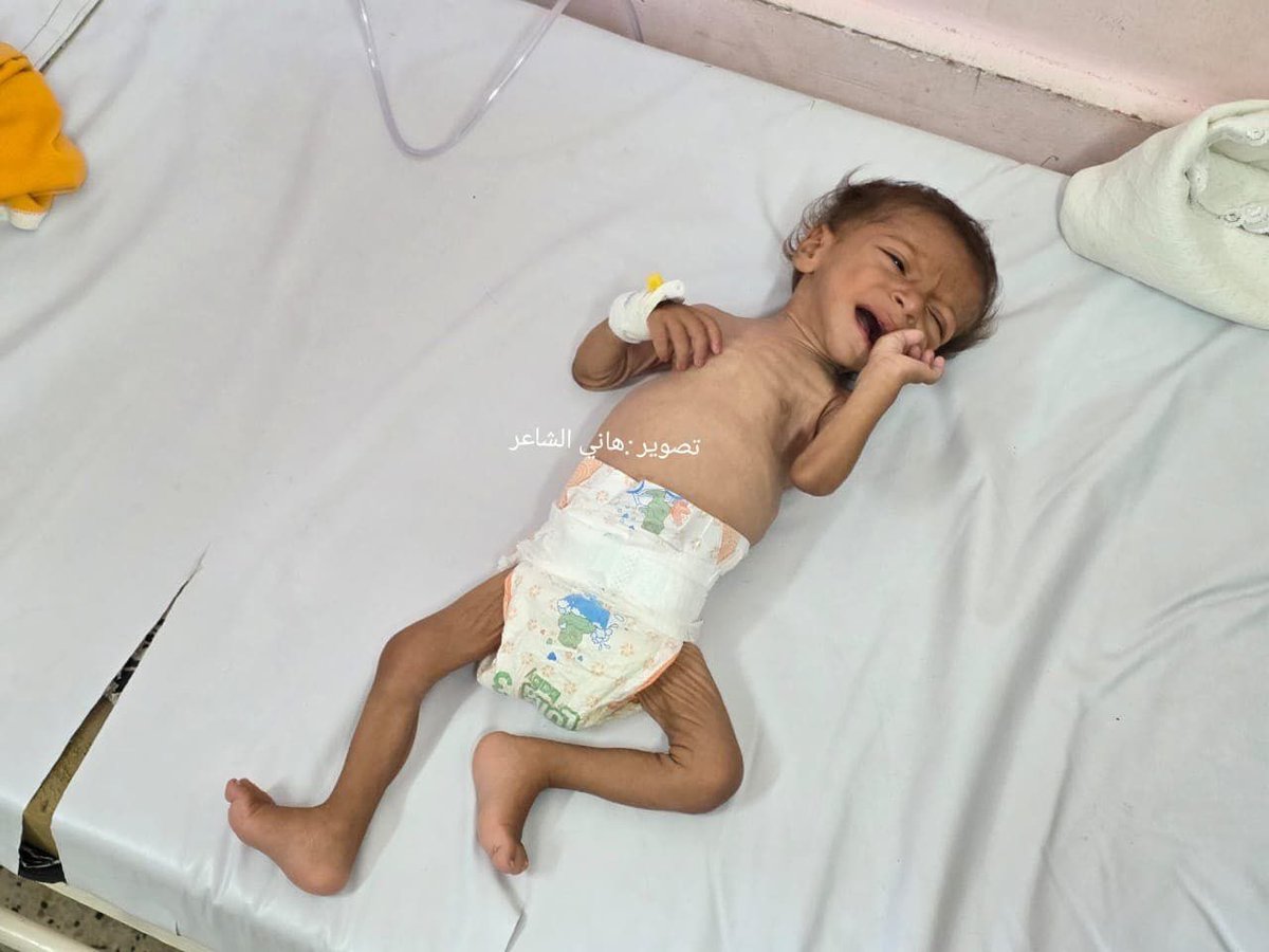 warfareanalysis's tweet photo. ⚡️Gaza sources:

After appeals for medical treatment, 8-month-old baby Muhammad Muhammad Qwaider, displaced from eastern Khan Younis, has died after his health deteriorated.

Muhammad was the only son of his father, who was killed by Israel. https://t.co/cLDFYtCfoj
