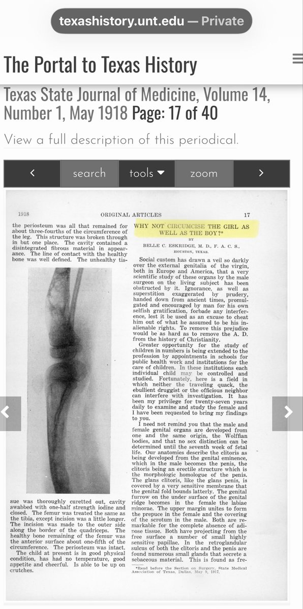 DontTreadUpon's tweet photo. I dont agree with their feminist messages &amp; dont know where they stand on circumcision (mutilation) of baby boys, but I think there’s something to learn from Femen feminists. This fierce approach is likely what helped women stand up to doctors &amp; outlaw female circumcision in 1977 https://t.co/at3g5ztx1o