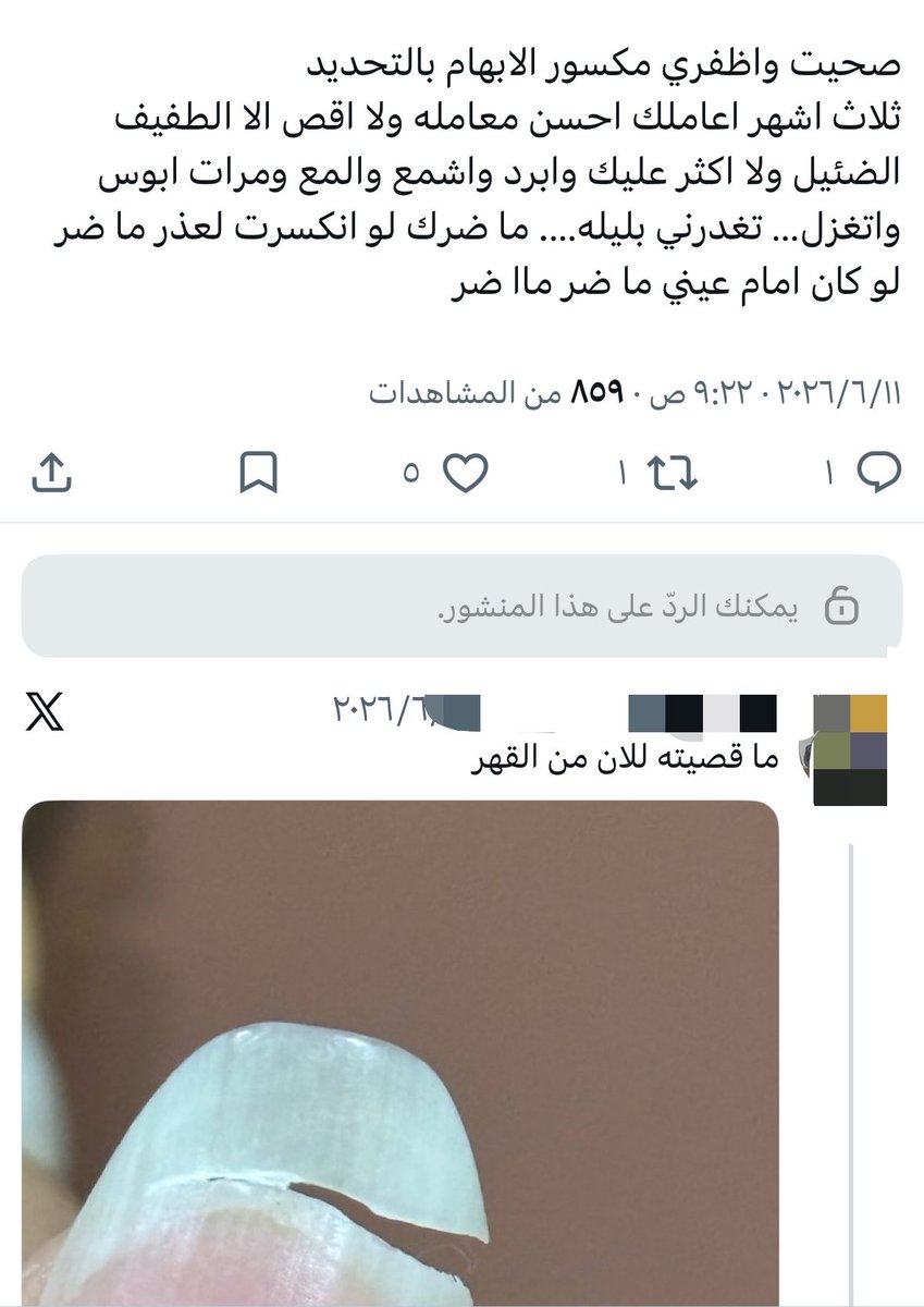 77hah77_'s tweet photo. ما ضر يا كبير الاظفار https://t.co/ML6QdlLeTt