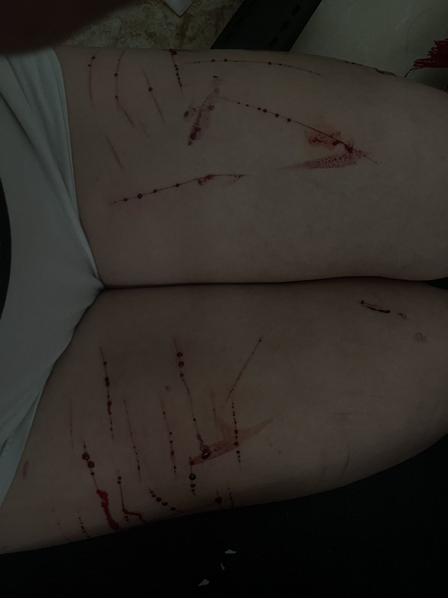 valvalemmm's tweet photo. FAKE MAKEUP 
FAKE BLOOD
fake all makeup SFX 
not real. 
#slittwt #shitwt https://t.co/arcGBZgr1c