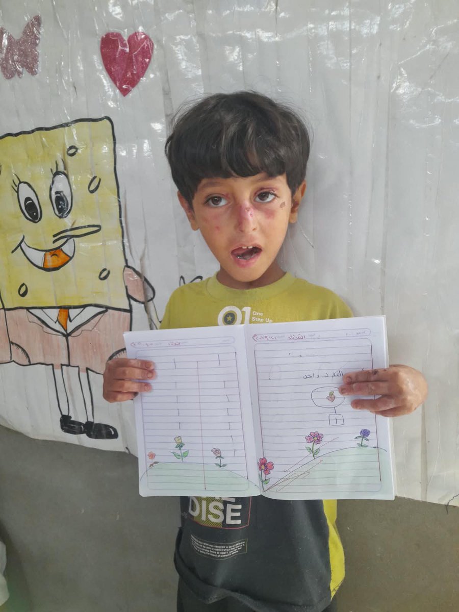 idz42t's tweet photo. 🥺 Tiam doesn’t ask for much… just a chance to be a child.
To laugh, play, and dream like other children. 💙
Your support can help give him more moments of childhood. 🙏
🔗 https://t.co/HEL9bvpsWL https://t.co/zrDzrdCU7I