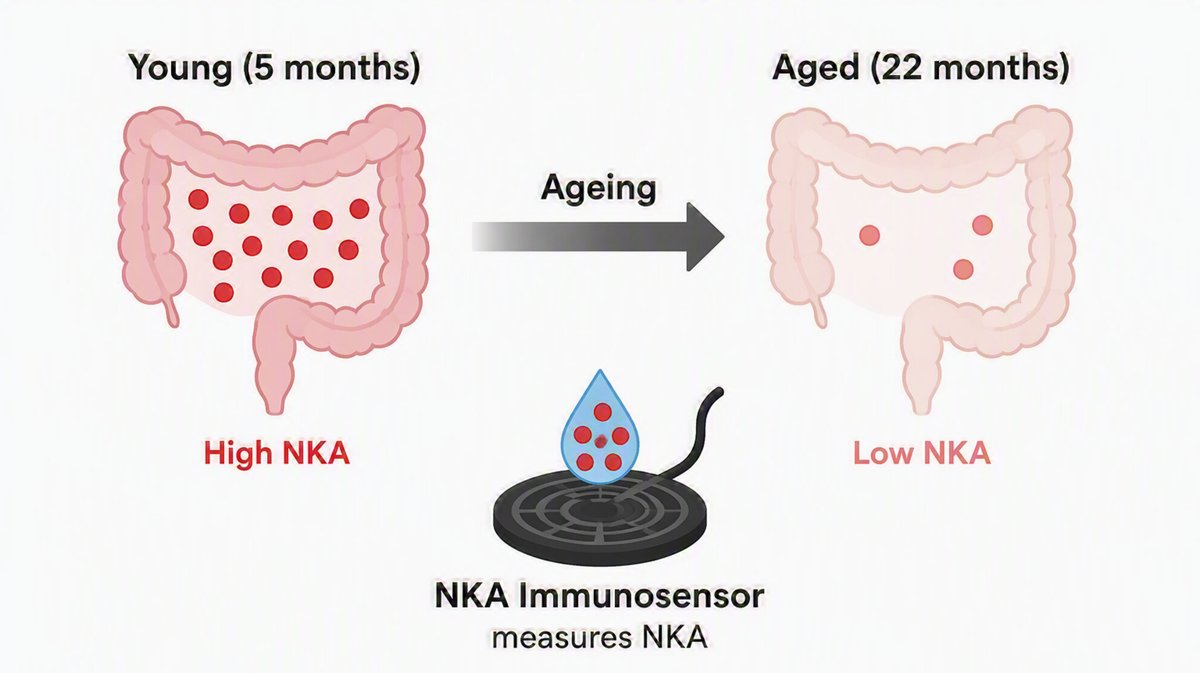 NGMJournal's tweet photo. 🆕🔥Age-related reductions in colonic Neurokinin A #NKA‼️
🎯A 3D-printed immunosensor detected⬇️NKA content &amp; release in the aged colon
💡Fecal NKA mirrored tissue changes, highlighting a potential noninvasive biomarker of bowel aging. #Bowel dysfunction
👉https://t.co/BtHCHd2Dkq https://t.co/Qa2koG8uK7