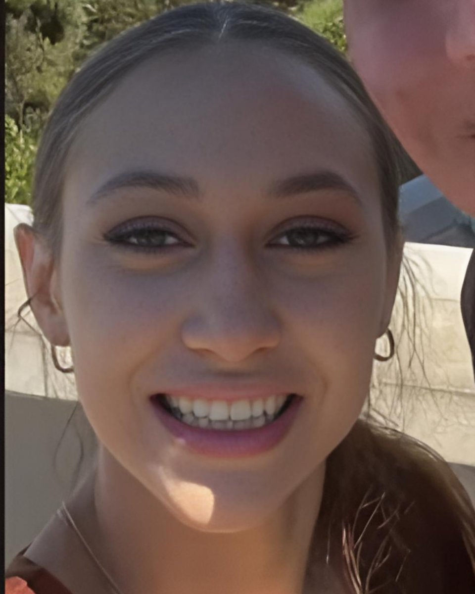 DavidJHarrisJr's tweet photo. 🚨WOW: 23-year-old Alexis Lorenze goes viral on social media after suffering a severe medical crisis following hospital vaccinations!

In September 2024, 23-year-old Alexis Lorenze sparked massive online debate after posting heartbreaking videos from her hospital bed, showing severe facial swelling, extreme bruising, and dark purple lesions across her body.

Lorenze was admitted to UCI Medical Center in Orange, California, to seek treatment for Paroxysmal Nocturnal Hemoglobinuria (PNH)—a rare, life-threatening blood disorder that causes the immune system to break down red blood cells. 

Because standard PNH targeted treatments (like complement inhibitors) suppress specific parts of the immune system and increase susceptibility to severe infections, standard medical protocols require patients to receive vaccinations—including meningitis and pneumonia shots—prior to or alongside therapy. 

Lorenze, who had previously abstained from vaccines for religious reasons, alleged that hospital staff required her to receive three vaccines simultaneously before proceeding with her full treatment plan. Within minutes of receiving the shots, her health rapidly deteriorated, leading to severe reactions, widespread purpura/bruising, and temporary loss of vision.

The controversy ignited fierce debate across social media:
• Family & Supporters: Alleged the hospital overwhelmed her fragile immune system by administering multiple shots at once to a critically ill PNH patient, sparking public calls for accountability.
• Medical Experts & Fact-Checkers: Pointed out that PNH itself triggers severe blood clotting, hemolytic crises, and skin lesions—especially during flare-ups. Medical professionals noted that while vaccinations or underlying infections can trigger a severe PNH flare-up, her underlying blood disorder was the primary driver of her life-threatening symptoms.

Lorenze and her family used social media to document her fight, demand medical answers, and ask followers to share her story to raise awareness about patient rights and rare blood disorders!