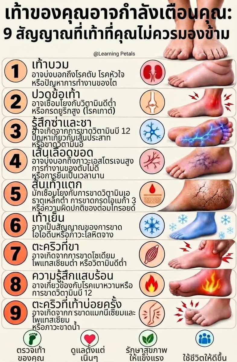 Pk96356's tweet photo. เท้ากำลังบอกอะไรเรา? 9
 สัญญาณที่ไม่ควรมองข้าม

“คุณเคยสังเกตเท้าตัวเองจริง ๆ ไหม?” 👣
บางอาการที่เราเคยมองว่าเป็นเรื่องธรรมดา อาจมีสาเหตุที่ควรใส่ใจ
ลองเช็กกันครับว่า…คุณมีข้อไหนบ้าง? https://t.co/VuaNQoWIvN