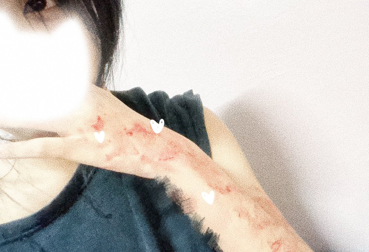 Chichichun_nn's tweet photo. 起きた瞬間から詰んでる〜〜

Fake blood 
Not real https://t.co/OpJcyZNX48