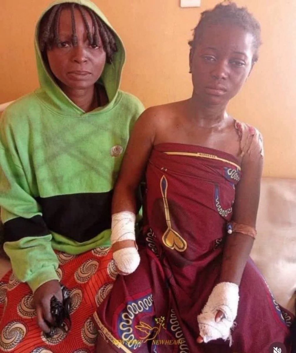 andrewc44104127's tweet photo. 🚨IS THIS WHAT YOU WANT FOR THE WEST?

A Muslim jihadist cut off the hands of a Christian girl because she refused to marry him and become a sex slave. She managed to escape before he tried to behead her.

This past year, more Christians have been killed in Nigeria than Palestinians in Gaza.

The media remains silent.
